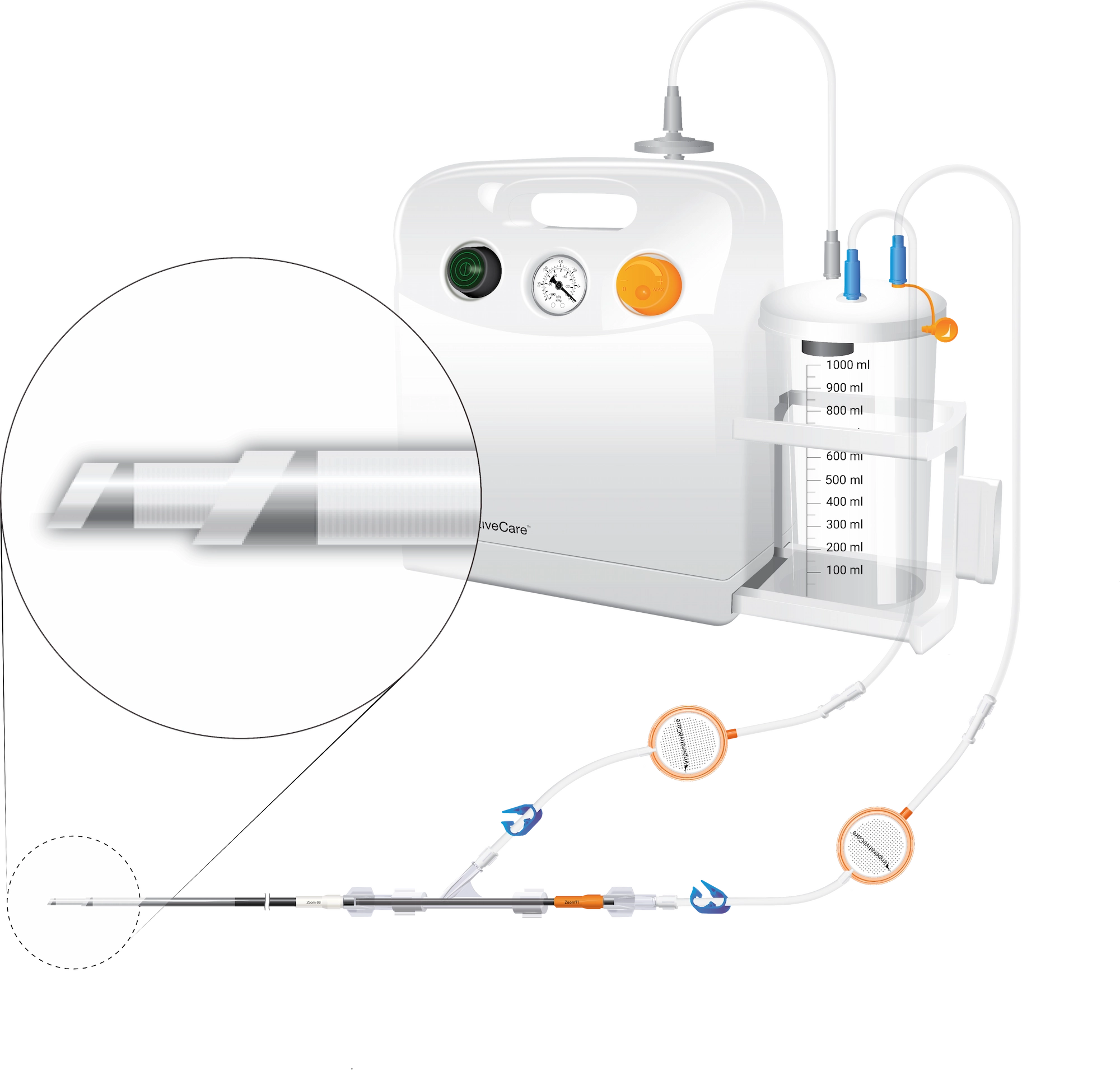 Dual Aspiration Catheter