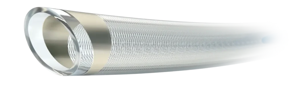 Prodigy Catheters telescoping