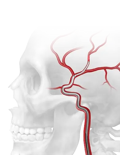 Skull with blood vessels